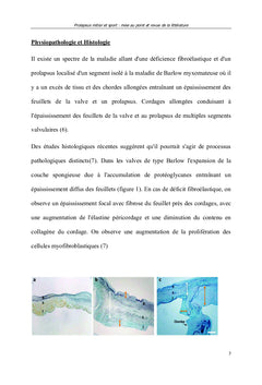 Prolapsus mitral et sport