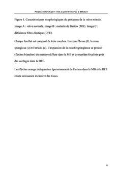 Prolapsus mitral et sport