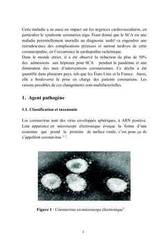 La COVID-19 et pathologies Cardiovasculaires
