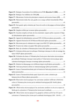 Cancer du sein et Evaluation de l'immunomarquage