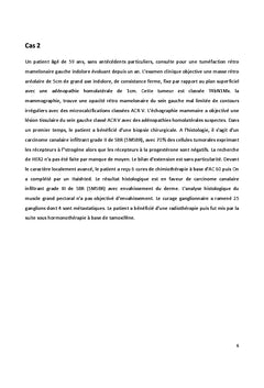 Cancer du sein chez l'homme