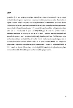 Cancer du sein chez l'homme