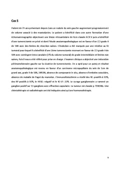 Cancer du sein chez l'homme