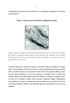Hémodynamique appliquée: de la macrocirculation à la microcirculation