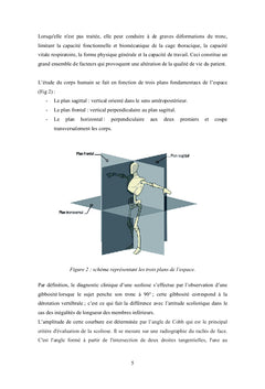 Impact de la scoliose idiopathique sur la marche chez l'adolescent