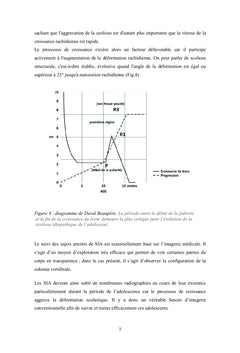 Impact de la scoliose idiopathique sur la marche chez l'adolescent