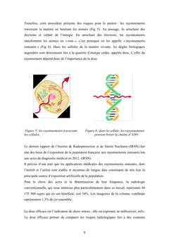 Impact de la scoliose idiopathique sur la marche chez l'adolescent