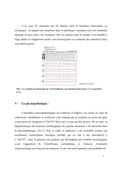 Manifestations neurologiques au cours du syndrome triple A