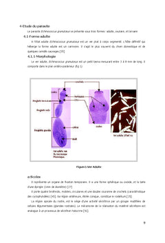 Mise au point du Western Blot pour le diagnostic de l'hydatidose