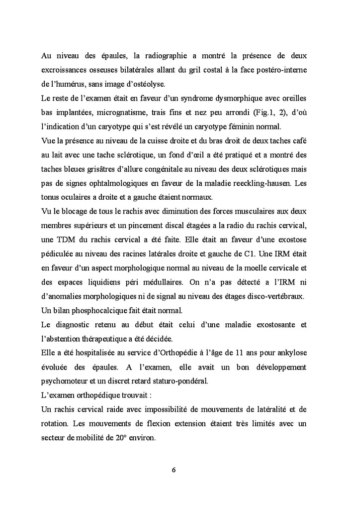 La fibrodysplasie ossifiante progrèssive