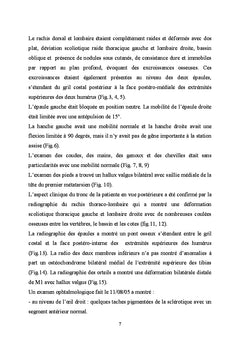La fibrodysplasie ossifiante progrèssive