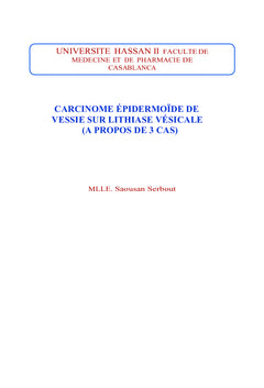 Carcinome epidermoïde de la vessie sur lithiase vesicale
