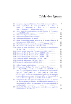 Detection d'extrasystoles ventriculaires par Support Vector Machines
