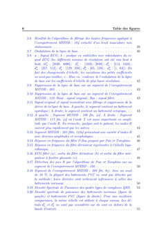 Detection d'extrasystoles ventriculaires par Support Vector Machines