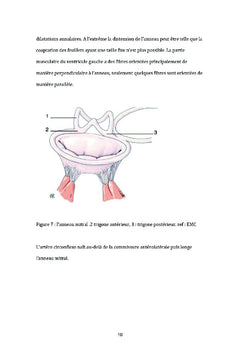 Comparaison de la voie de Guiraudon et du sillon de Sondergaard