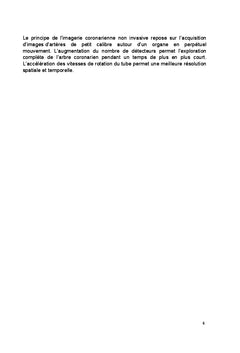 Performances, Limites et Implications Pratiques du Coroscanner