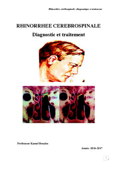 Rhinorrhee cerebrospinale diagnostic et traitement