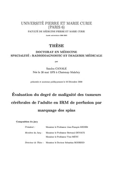 Irm de perfusion par marquage des spins