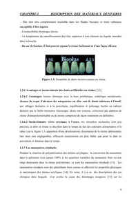 Matériaux Dentaires: Description, Usure et Fatigue