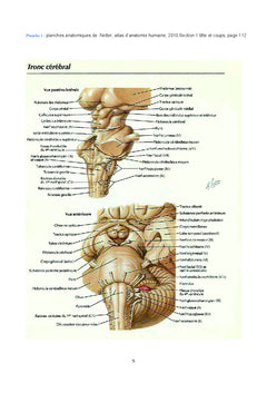 Gangliogliome desmoplasique infantile