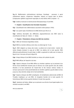 Les Malformations Artério-Veineuses des Membres