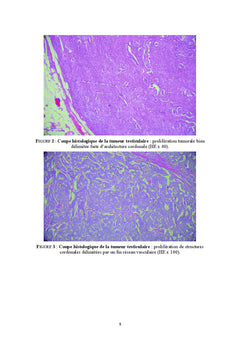 Tumeurs neuroendocrines du testicule: revue de la litterature