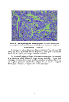 Tumeurs neuroendocrines du testicule: revue de la litterature