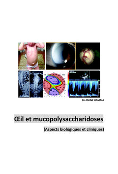 OEil et mucopolysaccharidoses