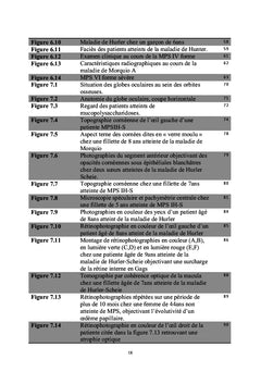 OEil et mucopolysaccharidoses
