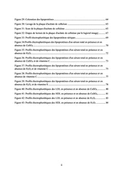 Etude de la migration electrophoretique des lipoproteines seriques