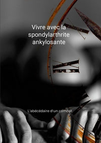 Vivre avec la spondylarthrite ankylosante