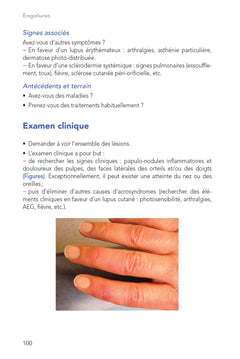 Téléconsultations en dermatologie: 77 situations