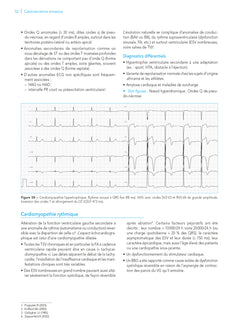 L'ECG de A à Z, 2e éd.