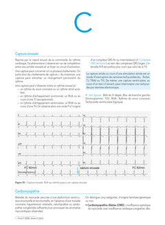 L'ECG de A à Z, 2e éd.