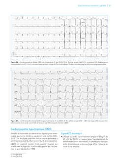 L'ECG de A à Z, 2e éd.