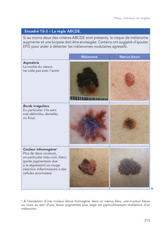 Bates : examen physique et interrogatoire du patient