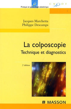 La colposcopie