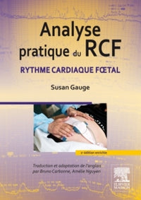 Analyse pratique du RCF: Rythme cardiaque foetal