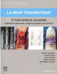 La main traumatique
