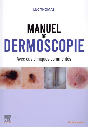 Manuel de dermoscopie