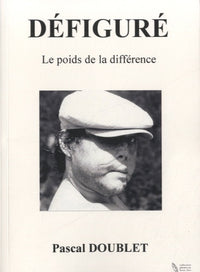 Défiguré - Le poids de la différence