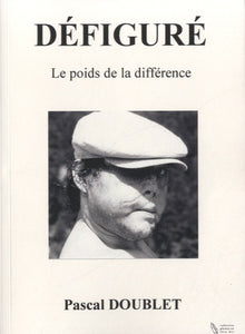 Défiguré - Le poids de la différence