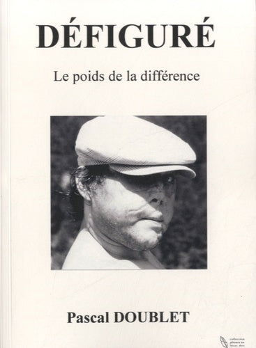 Défiguré - Le poids de la différence