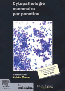 Cytopathologie mammaire par ponction