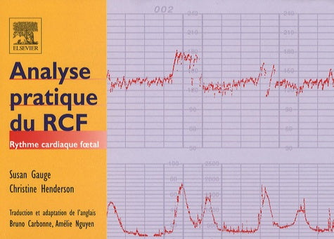 Analyse pratique du RCF: Rythme cardiaque foetal