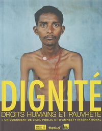 DIGNITE