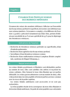Échographie doppler vasculaire