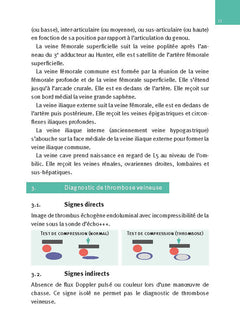 Échographie doppler vasculaire