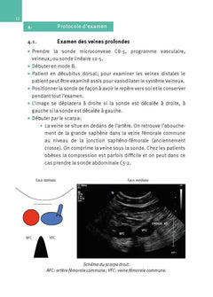 Échographie doppler vasculaire