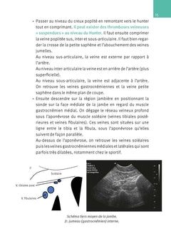 Échographie doppler vasculaire